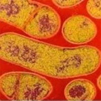 Опасные бактерии ботулизма могут быть в плотно упакованных продуктах Опасные бактерии ботулизма могут быть в плотно упакованных продуктах